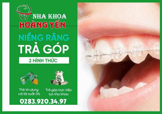 nieng-rang-tra-gop-nha-khoa-hoang-yen